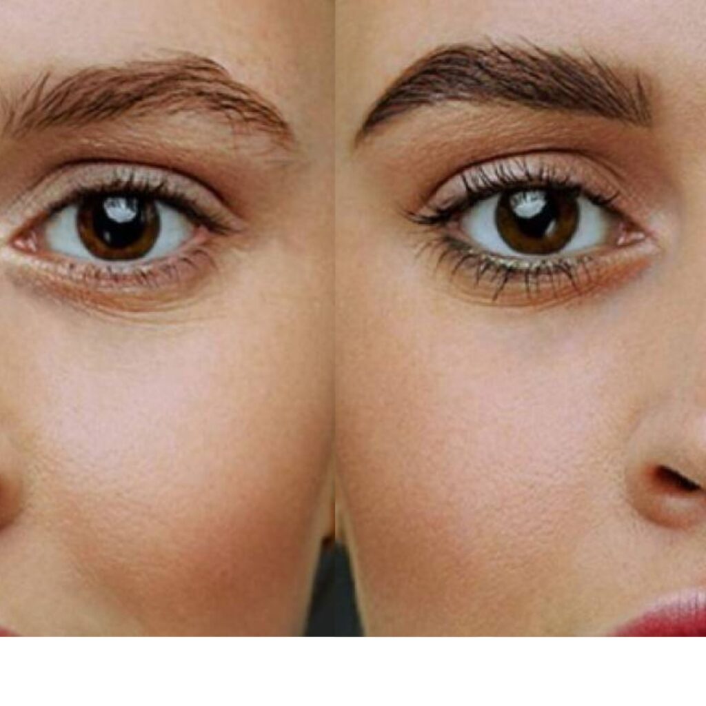 microblanding Arequipa